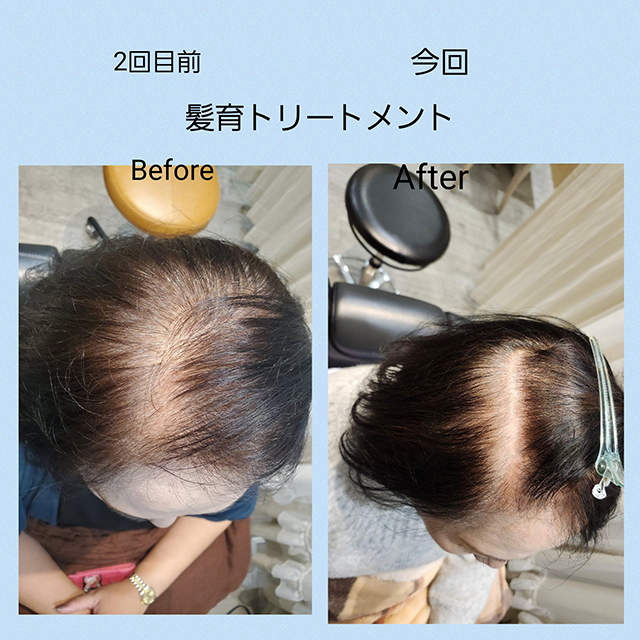 メニュー