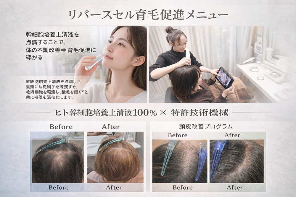 幹細胞培養上清液