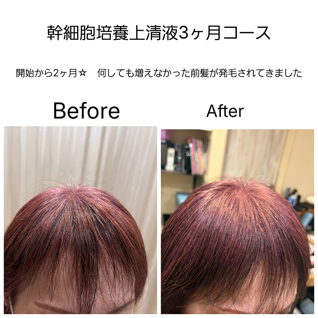 一人ひとりに合わせたオーダーメイド施術