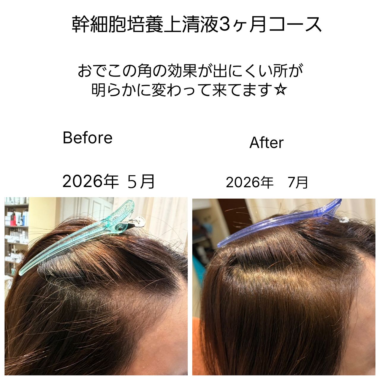 メニュー