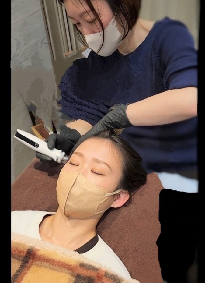 育毛促進ベーシックメニュー