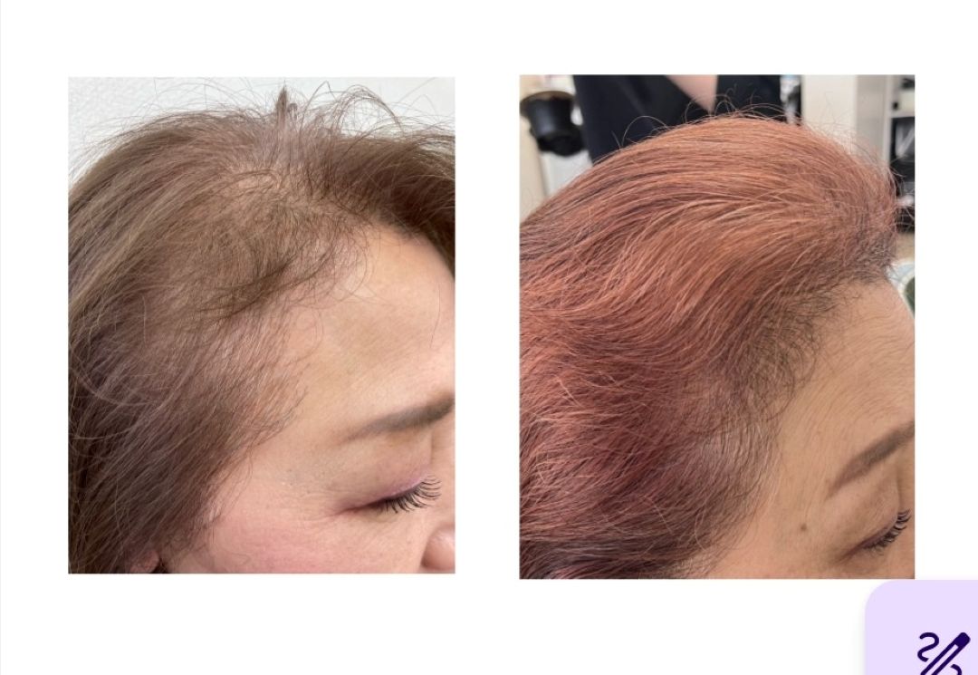 京都唯一の育毛専用ヘッドスパメニュー