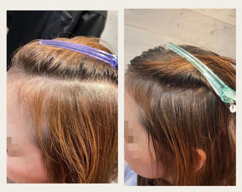 予防はできても、実際髪をしっかりさせるなら、やっぱり薄毛改善メニューは◎