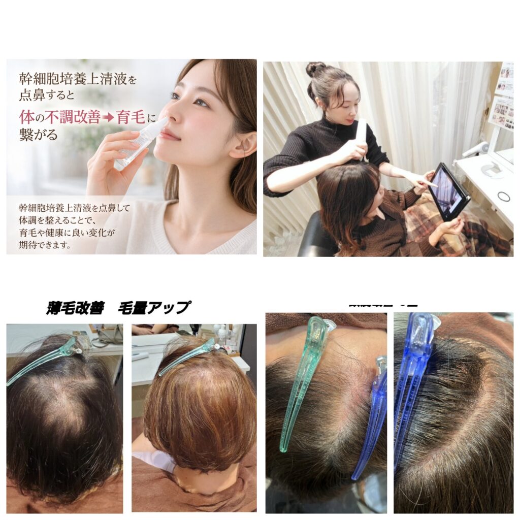 HARG治療やエクソソームと頭皮改善エステや髪育TRの違い