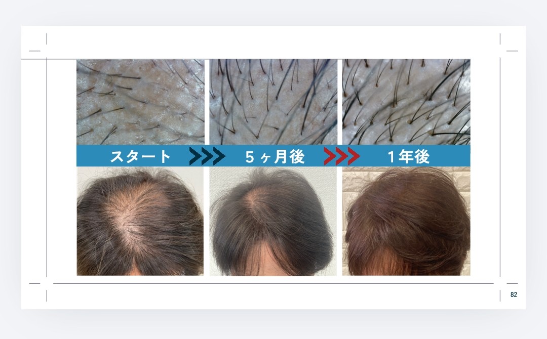  スタート　▶▶▶　5ヶ月後　▶▶▶　1年後