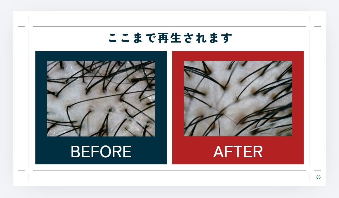  ここまで再生されます、BEFORE、AFTER