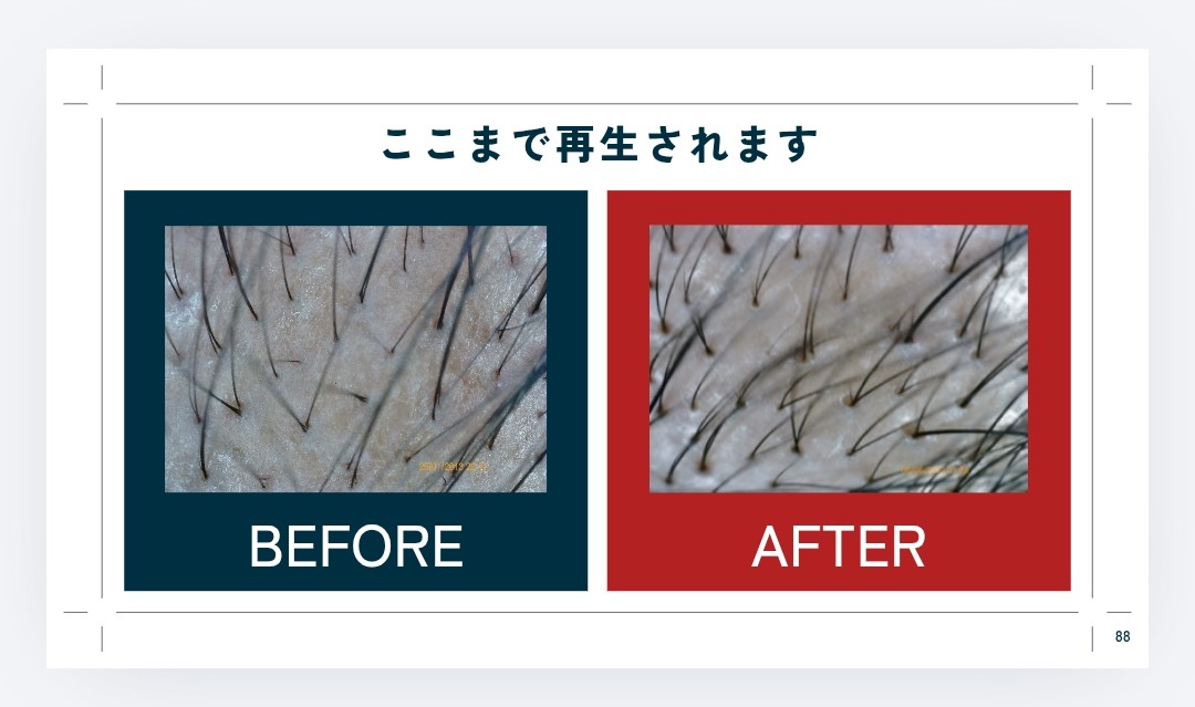  ここまで再生されます、BEFORE、AFTER