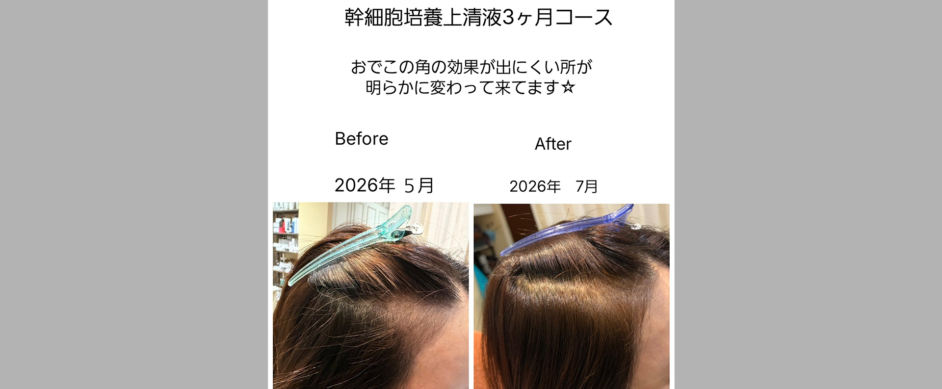 髪質改善 soiris