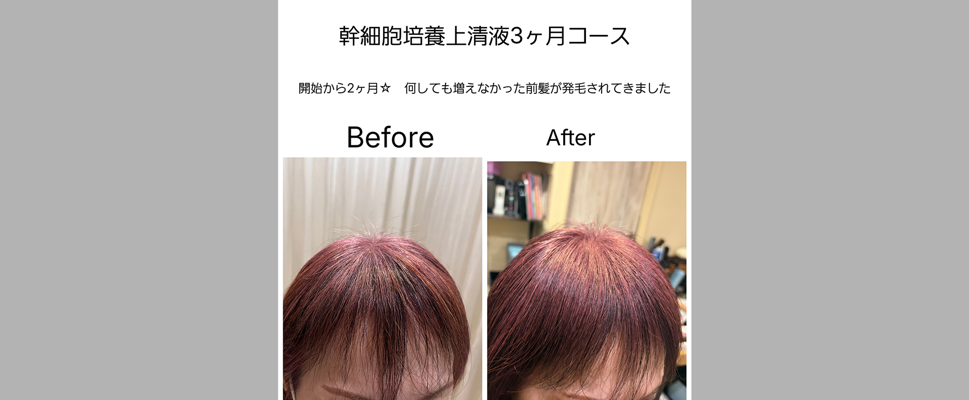 髪質改善 soiris