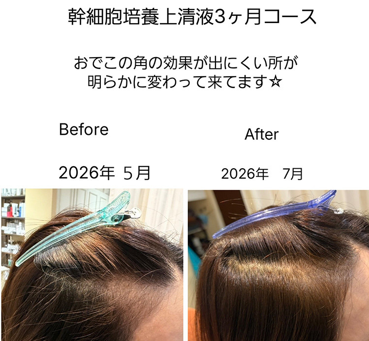 髪質改善 soiris