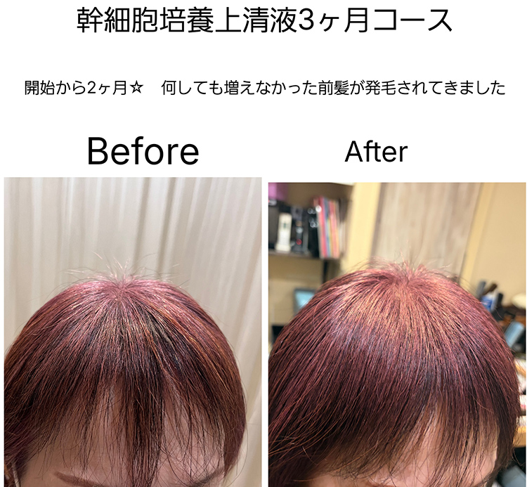髪質改善 soiris
